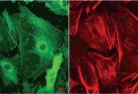 (ibidi)μ-Dish 35 mm, high ESS 彈性支撐表面-81291 81391 81191 81199