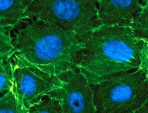 (ibidi)μ-Slide 2孔腔室載玻片-80286 80281 80284 80282 80287 80296 80292 80294 80291 80297